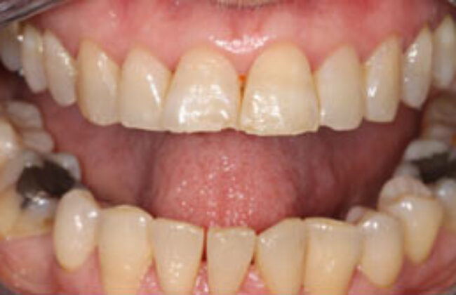 Before