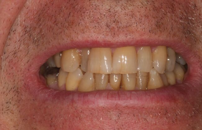 Before