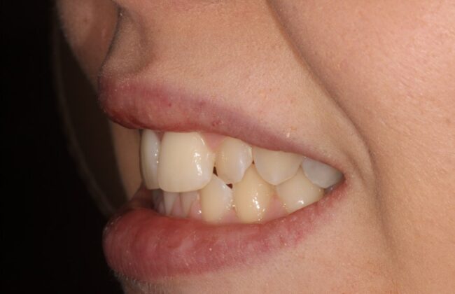 Before