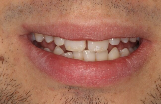 Before