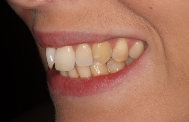 Before