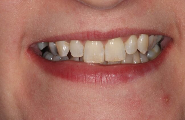 Before
