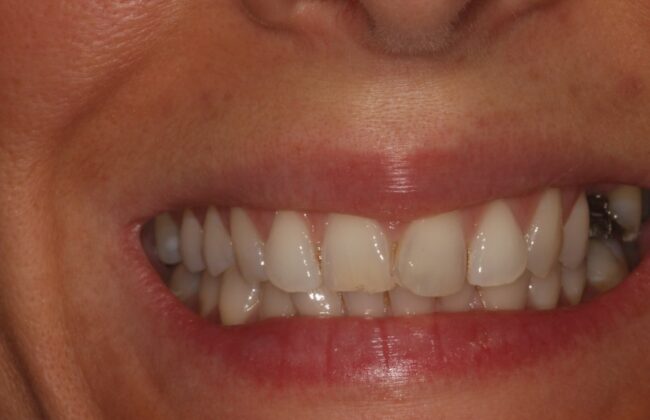 Before