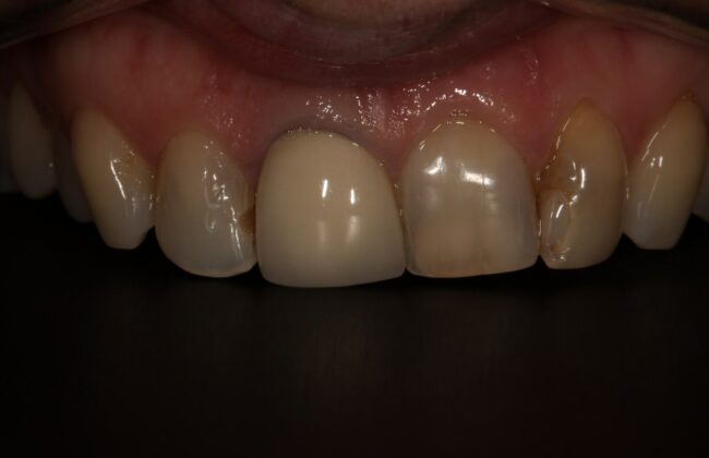 Before