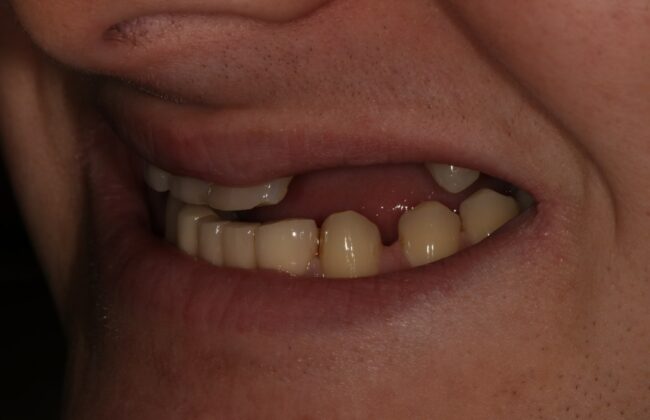 Before