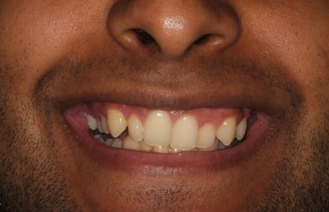 Before