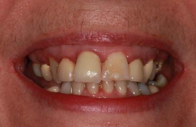 Before