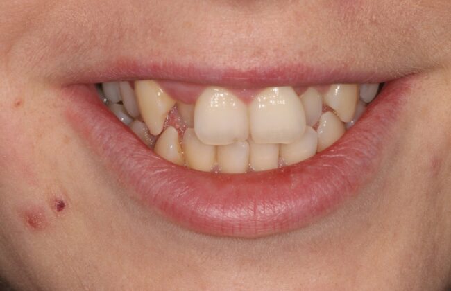 Before