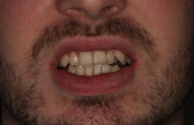 Before