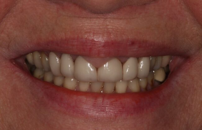 Before
