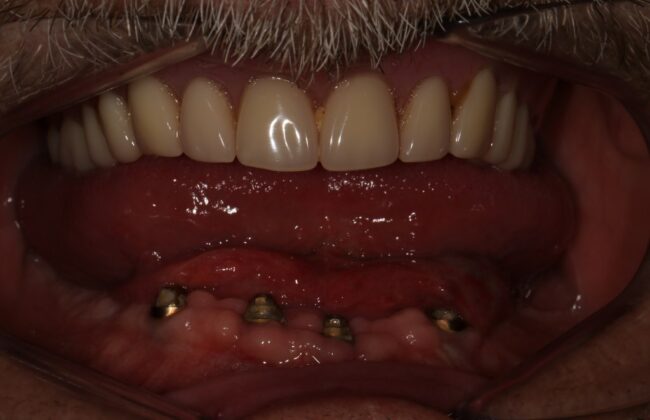 Before