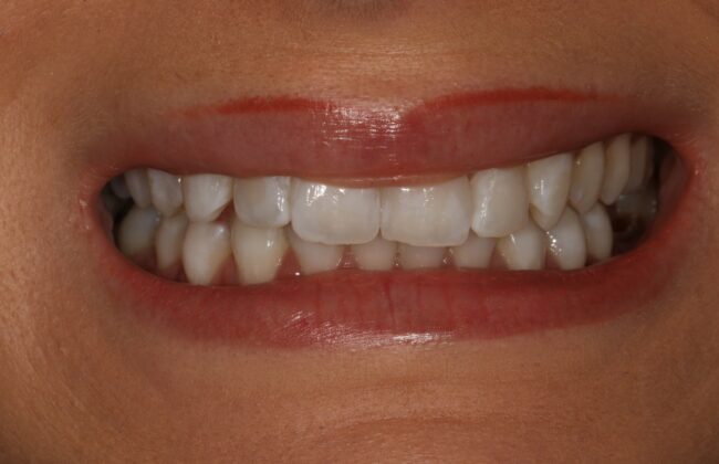 Before