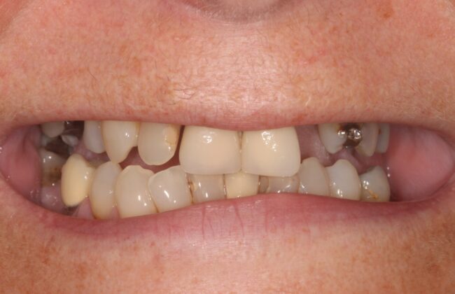 Before
