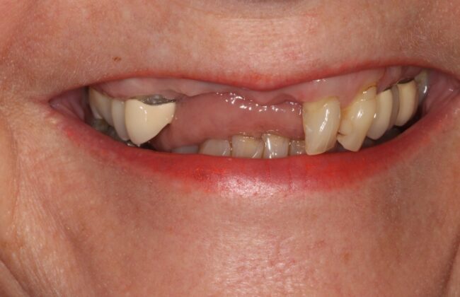 Before