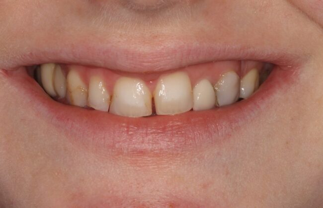 Before