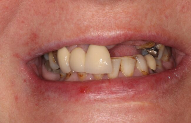 Before