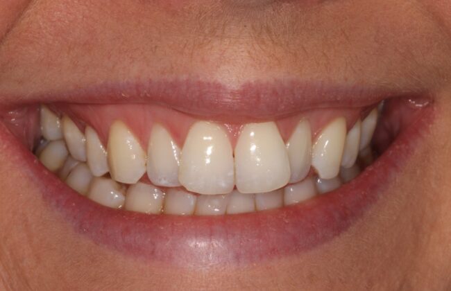 Before