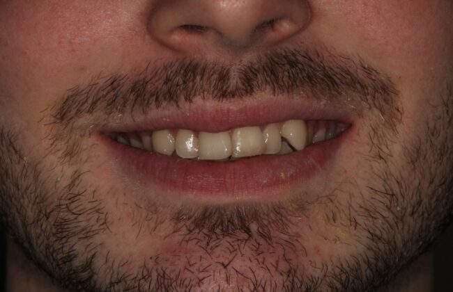 Before