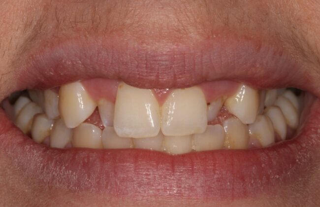 Before