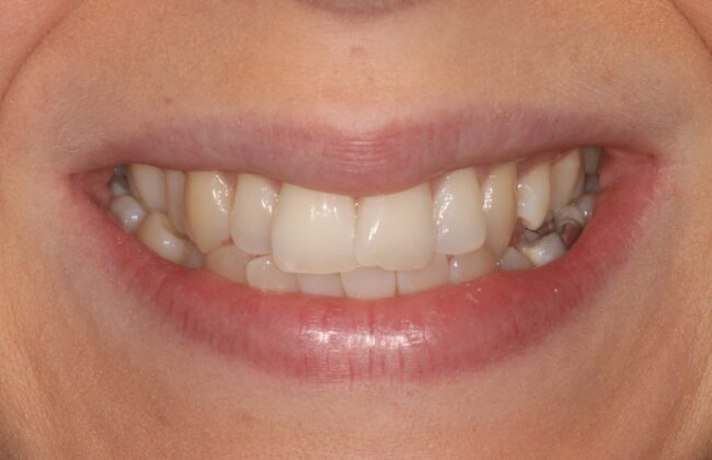 Before