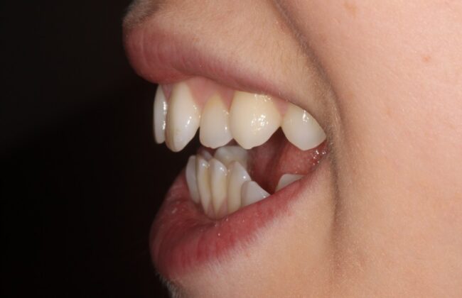 Before