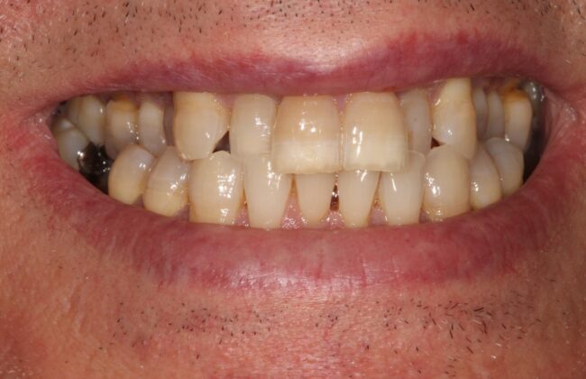 Before