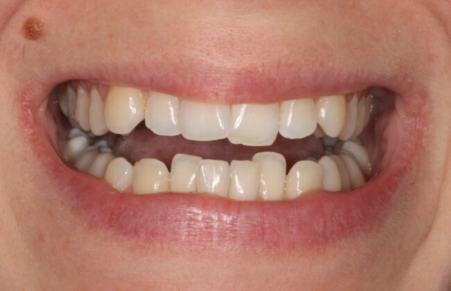 Before