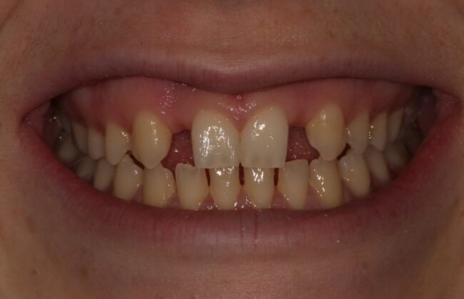 Before