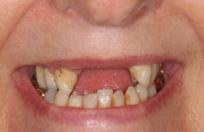 Before