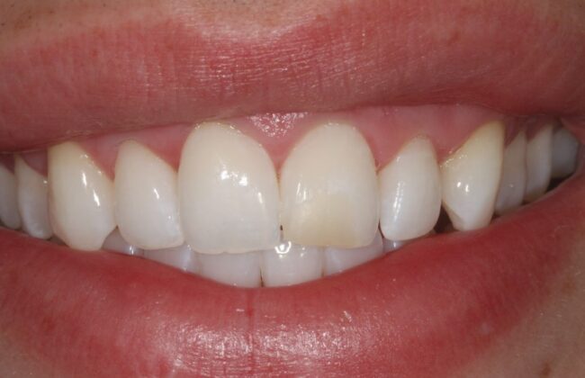 Before