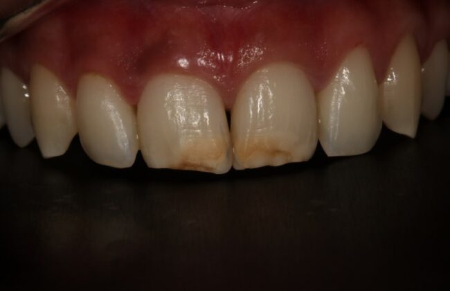 Before