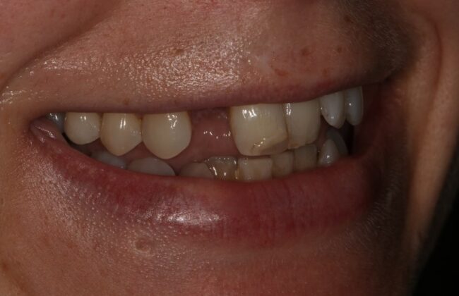 Before