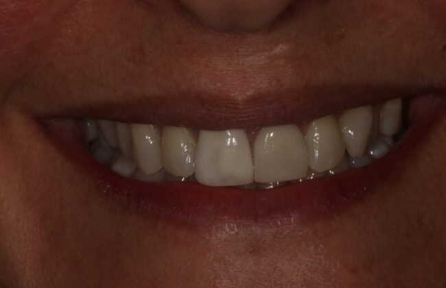 Before