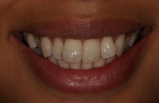 Before