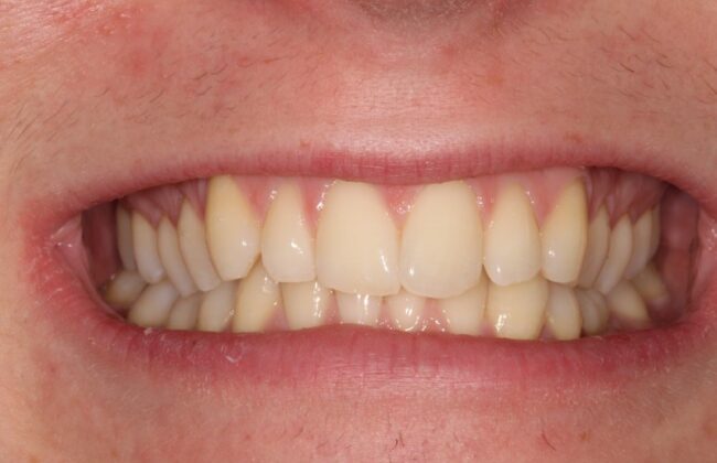 Before