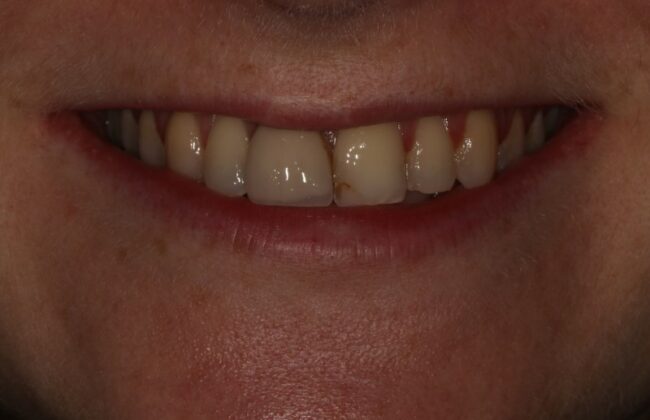 Before