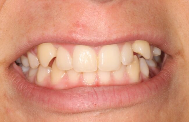 Before