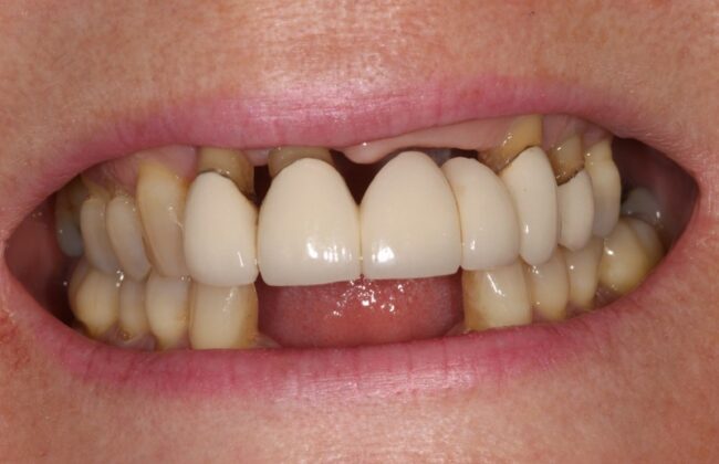 Before