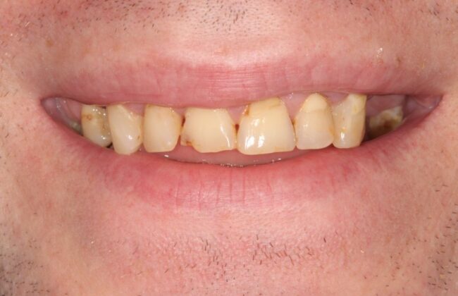 Before