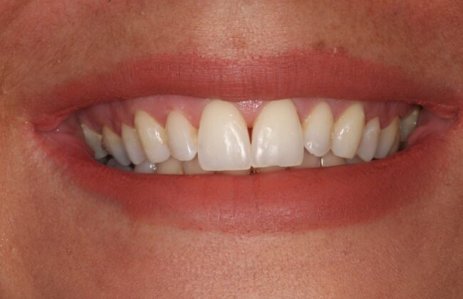 Before