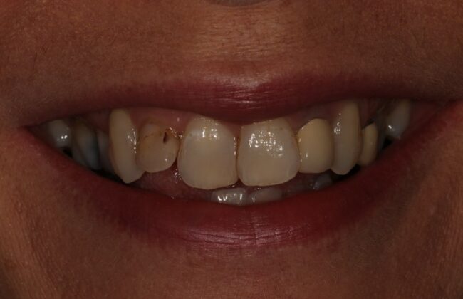 Before