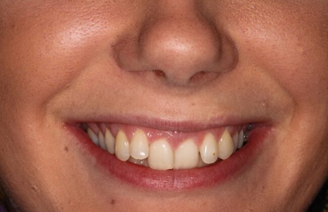 Before