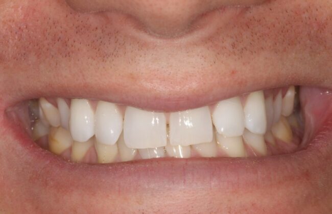 Before