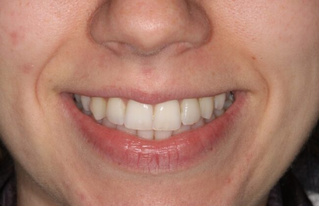 Before