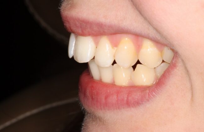 Before