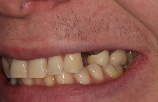 Before