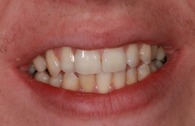 Before
