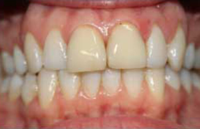 Before