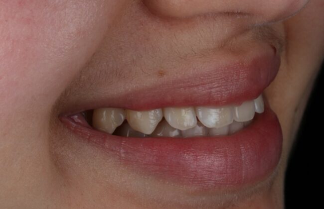 After