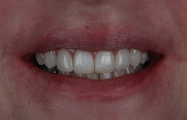 After